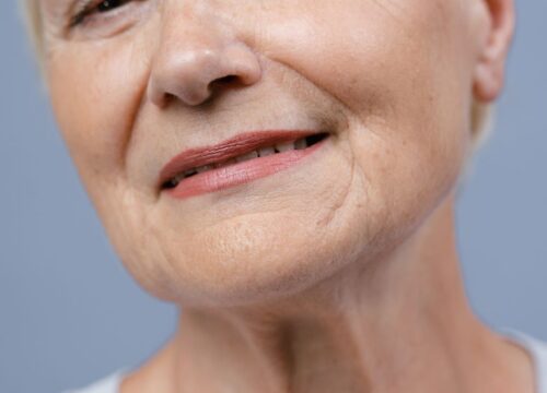 Thin Lips