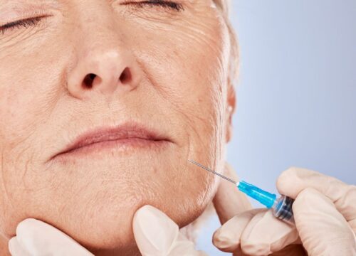 Dermal Fillers: How They Restore Volume and Smooth Wrinkles