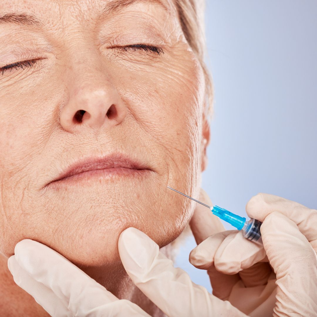 Dermal Fillers: How They Restore Volume and Smooth Wrinkles