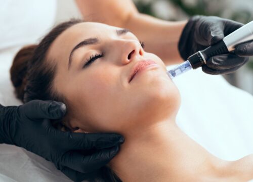 Microneedling vs. Laser Treatments: Understanding the Differences and Benefits