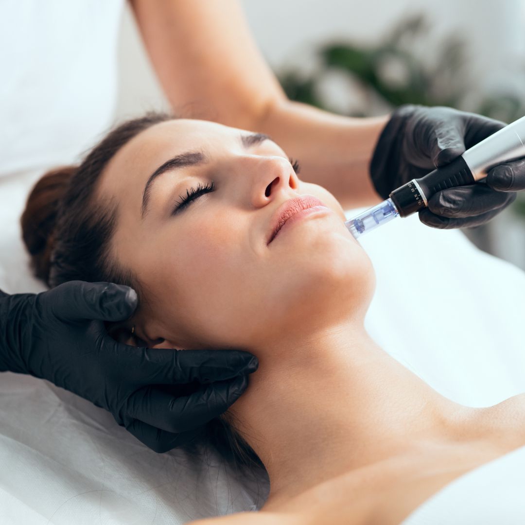 Microneedling vs. Laser Treatments: Understanding the Differences and Benefits