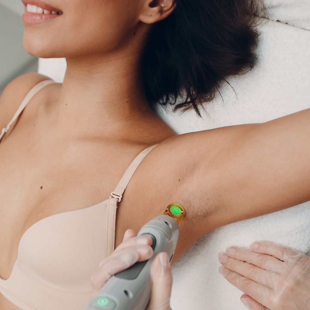 Splendor X by Lumenis Laser Hair Removal: Safety and Long-Term Results