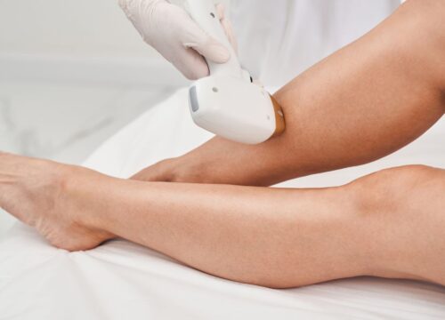 Unveiling Smooth Skin: Laser Hair Removal vs. Waxing and Shaving Explained