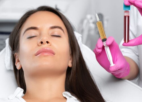 Benefits of PRP (Platelet-Rich Plasma) Therapy in Skin Rejuvenation