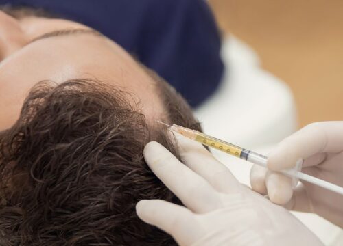 PRP for Hair Restoration: Understanding the Science and Success Rates