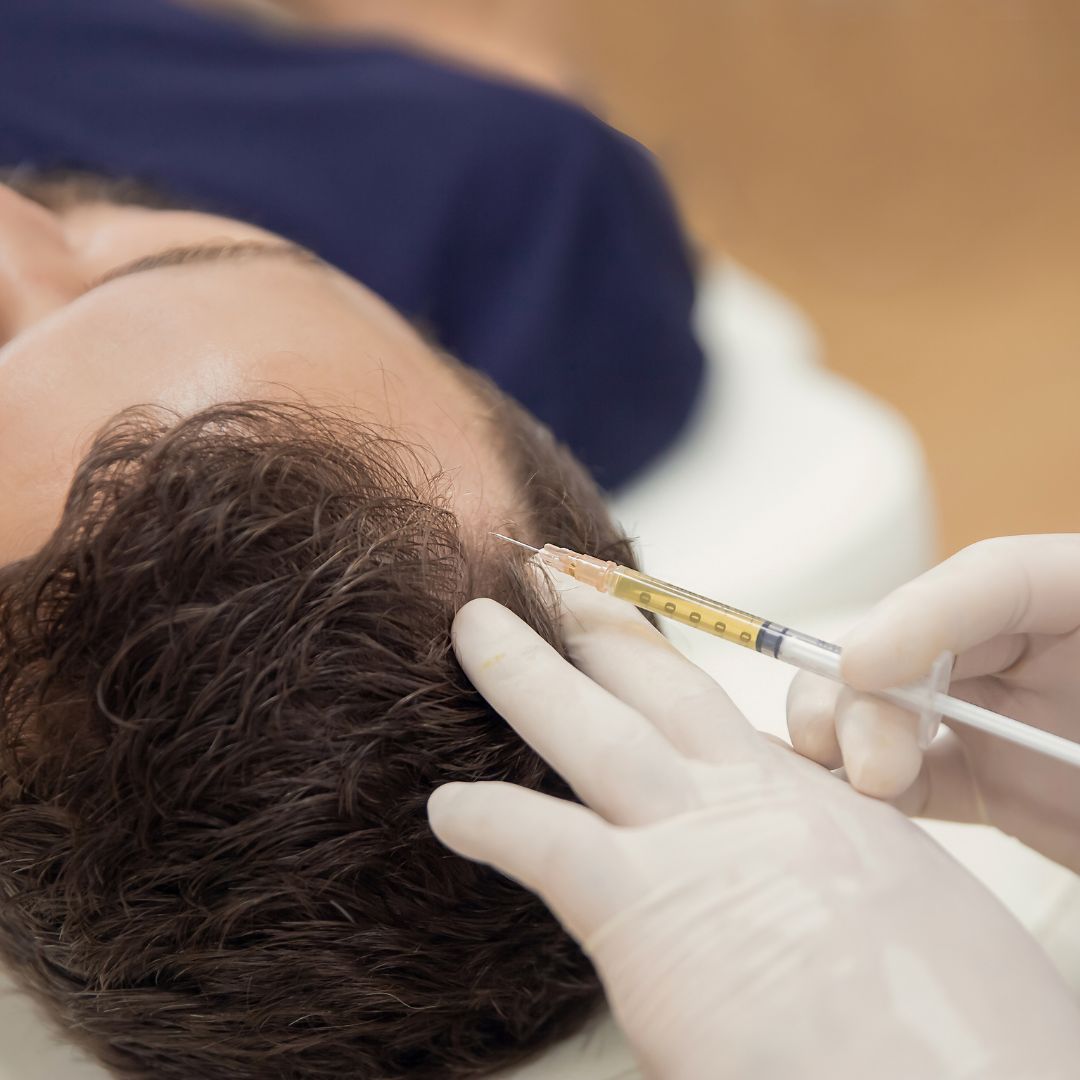 PRP for Hair Restoration: Understanding the Science and Success Rates